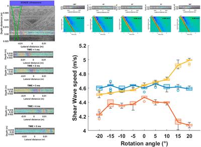 Detection of natural pulse waves (PWs) in 3D using high frame rate imaging for anisotropy characterization